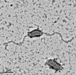 Figure 2. Transmission electron micrograph of Campylobacter hepaticus.